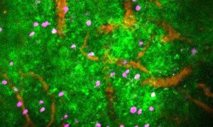 科学者は癌と戦う免疫細胞を作成します