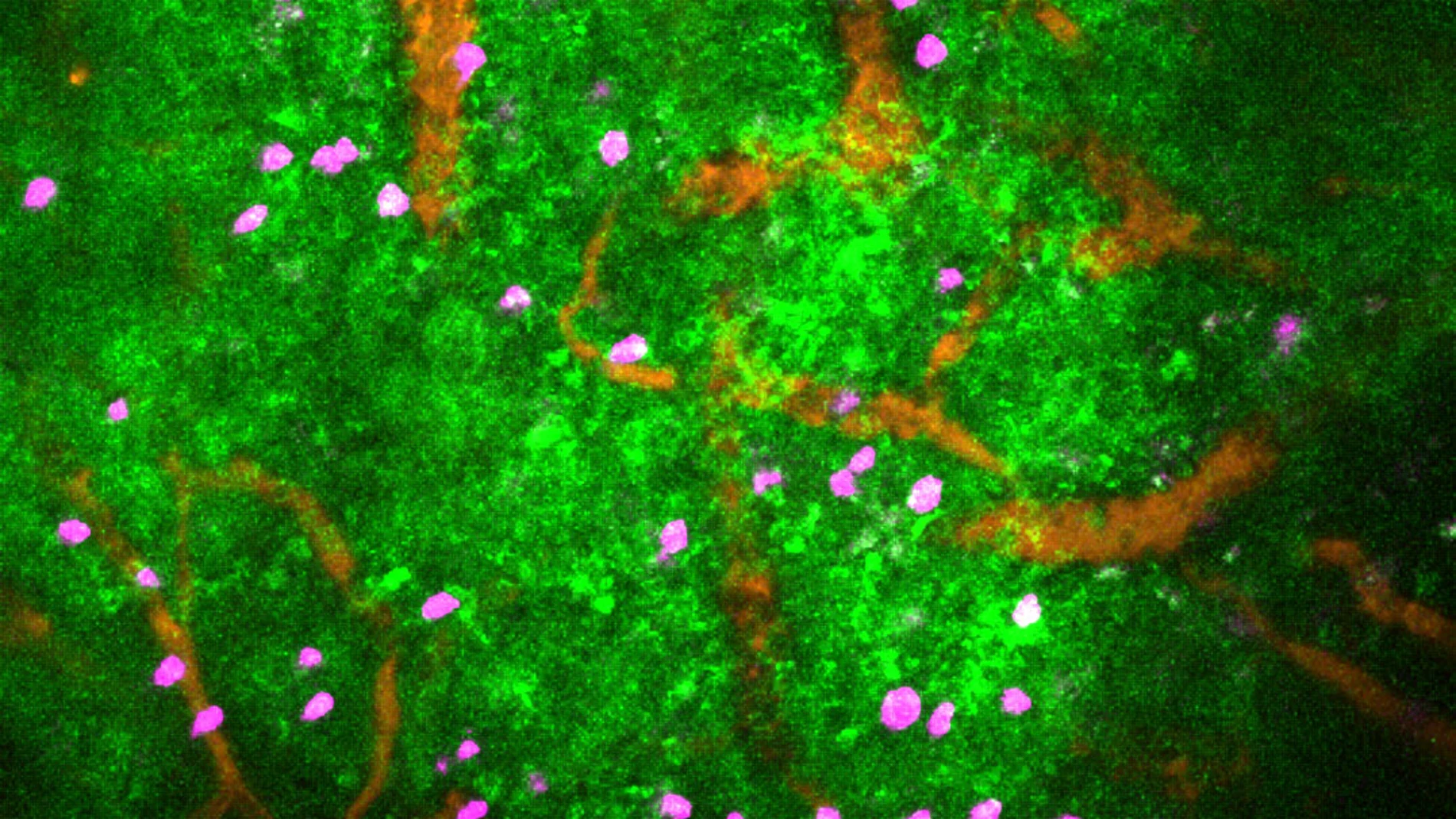 科学者は癌と戦う免疫細胞を作成します