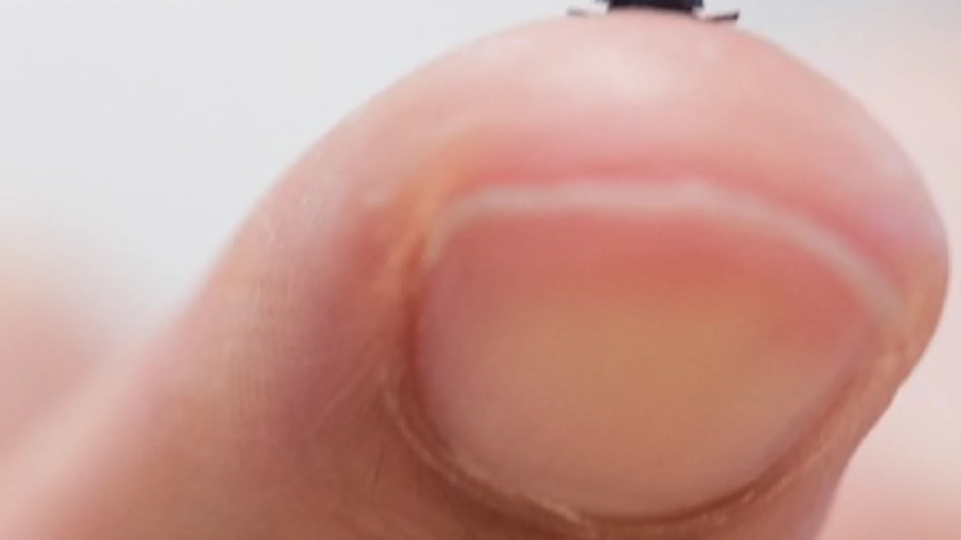 この種子サイズのロボットは外科手術に革命をもたらす可能性を秘めています